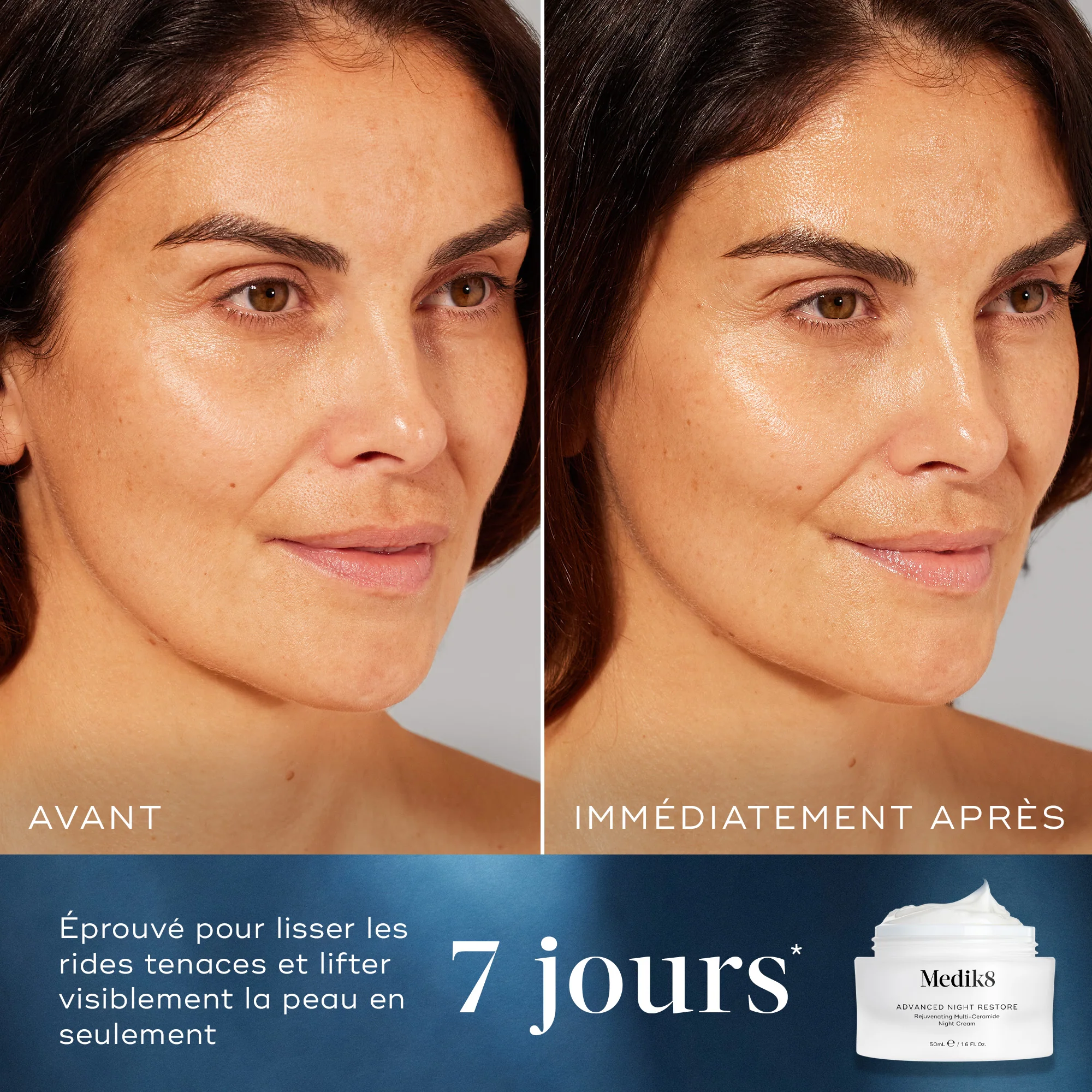Advanced Night Restore ™ - Image 4