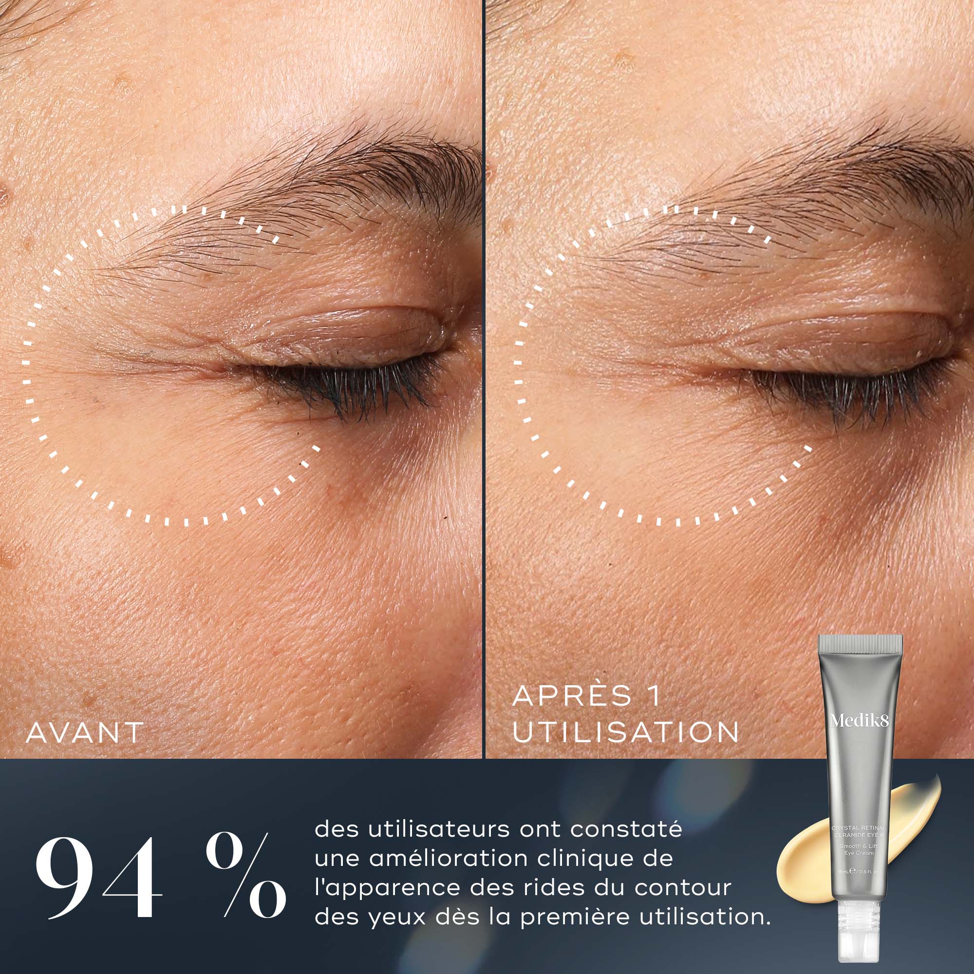 Crystal Retinal® Ceramide Eye - Image 3
